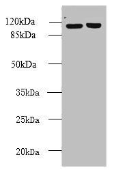 RPGR antibody