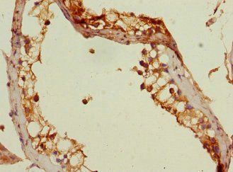RPGRIP1 Antibody