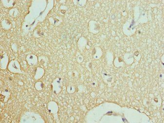 RPH3A Antibody