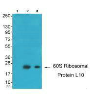 RPL10 antibody