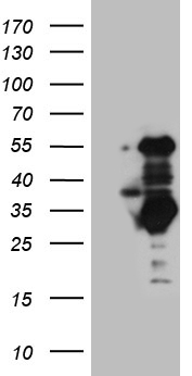 RPL10A Antibody
