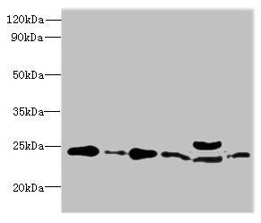 RPL10L Antibody