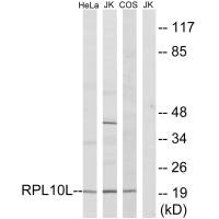 RPL10L Antibody