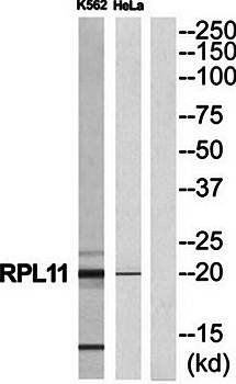 RPL11 antibody