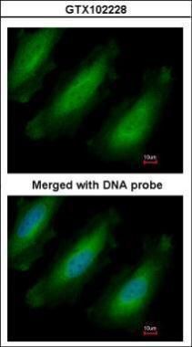 RPL13A Rabbit Polyclonal Antibody