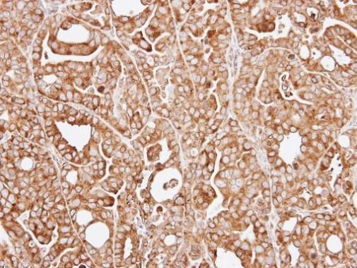 RPL13A Rabbit Polyclonal Antibody