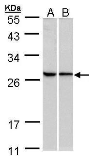 RPL13A Rabbit Polyclonal Antibody