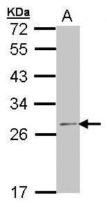 ODC Rabbit Polyclonal Antibody