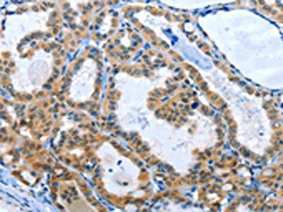 RPL15 Antibody
