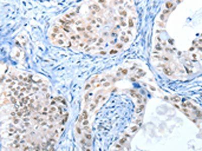 RPL15 antibody