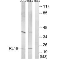 RPL18 antibody