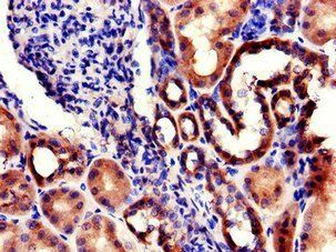 RPL22L1 Antibody