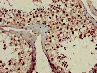 RPL23A Antibody