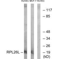 RPL26L1 antibody