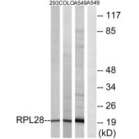 RPL28 Antibody