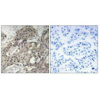 RPL3 Antibody