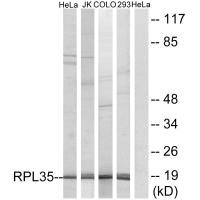 RPL35 antibody