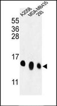 RPL36 antibody