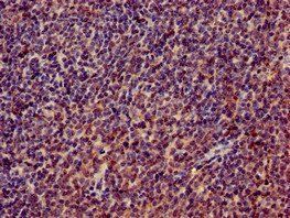 RPL4 antibody