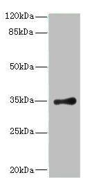 RPLP0 Antibody