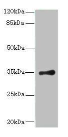 RPLP0 antibody