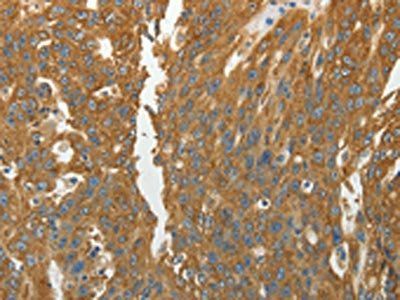 RPLP0 Antibody