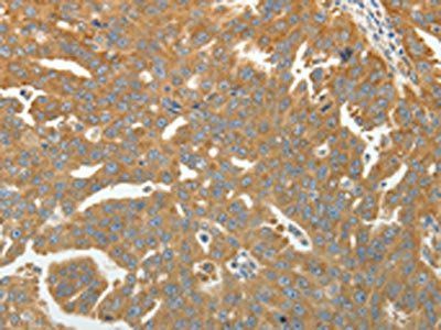 RPLP0 Antibody