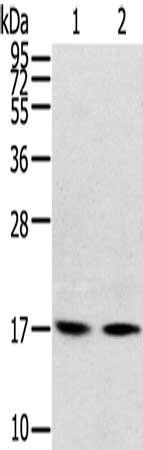 RPLP1 antibody