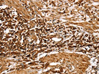 RPLP1 Antibody
