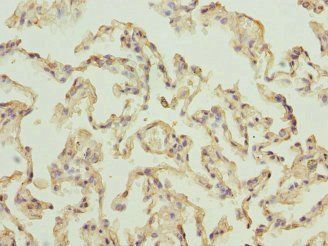 RPLP2 Antibody
