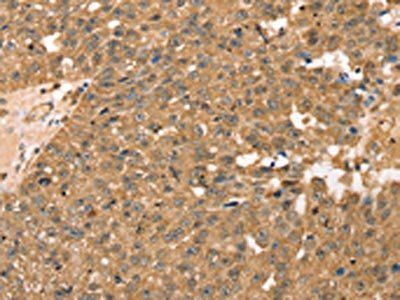 RPLP2 Antibody