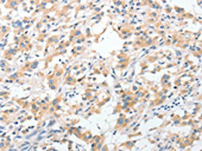 RPN1 antibody