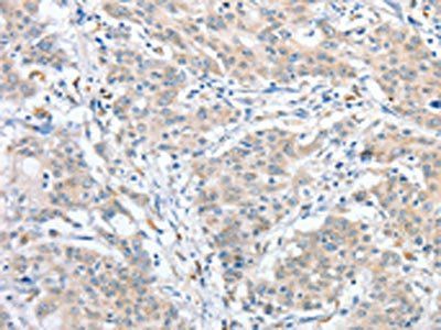 RPN1 Antibody