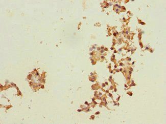 RPN2 Antibody