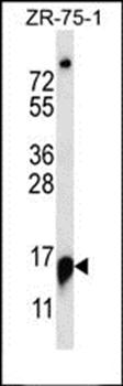 RPP25 antibody