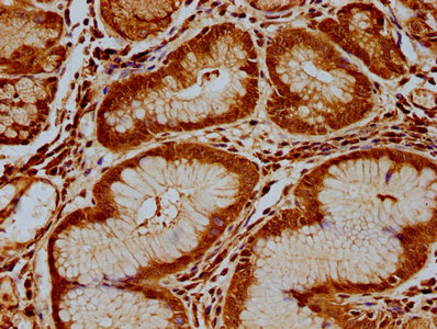 RPP38 Antibody