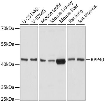 RPP40 antibody