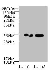 RPRD1A antibody