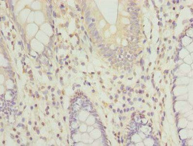 RPRD1B Antibody