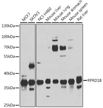 RPRD1B antibody
