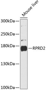 RPRD2 antibody