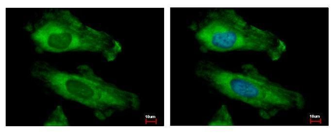 ribosomal protein S10 Antibody