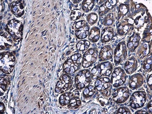 RPS10 Rabbit Polyclonal Antibody
