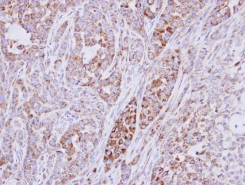 RPS10 Rabbit Polyclonal Antibody