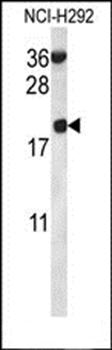 RPS12 antibody