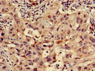 RPS15 Antibody