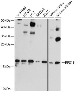 RPS18 antibody