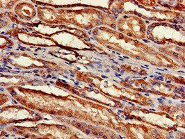 RPS2 Antibody