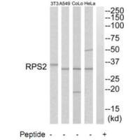 RPS2 antibody