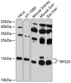 RPS20 antibody